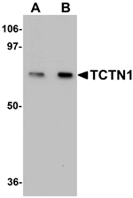 TCTN1 Antibody