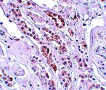 TCTN1 Antibody
