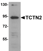 TCTN2 Antibody