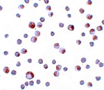 TCTN3 Antibody