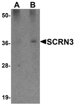 SCRN3 Antibody
