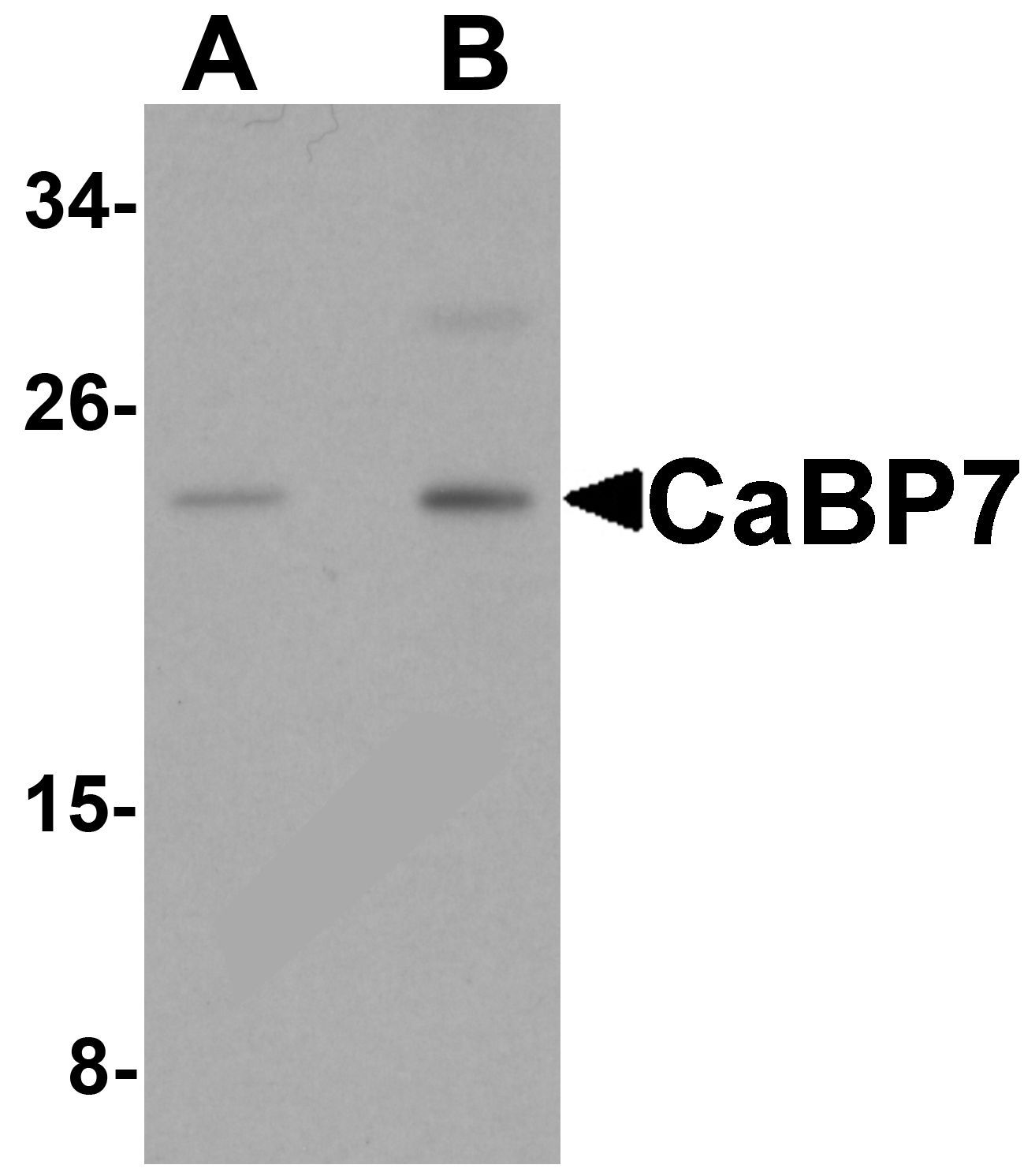 CaBP7 Antibody
