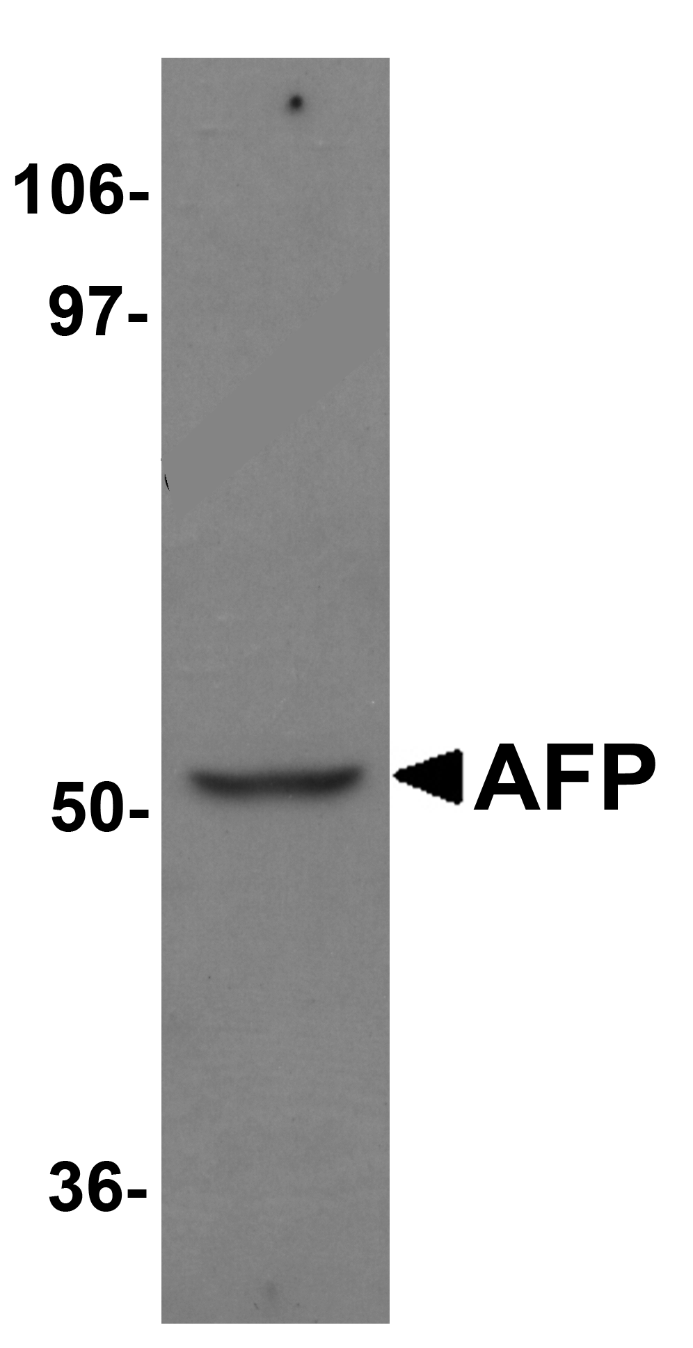 AFP Antibody