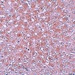 AFP Antibody