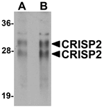 CRISP2 Antibody