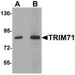TRIM71 Antibody