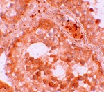 WDR92 Antibody