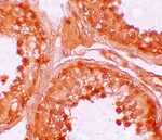 NOD6 Antibody