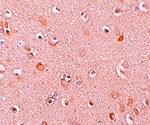 NALP5 Antibody
