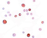 PLAC1 Antibody