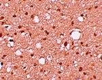 APBA2 Antibody