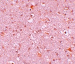 CXXC4 Antibody