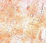 SYNPO2 Antibody