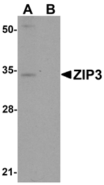 ZIP3 Antibody