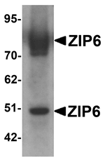ZIP6 Antibody