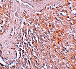 ZIP8 Antibody