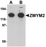 ZMYM2 Antibody