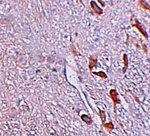 LRRTM1 Antibody