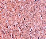 LRRTM2 Antibody