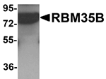 RBM35B Antibody