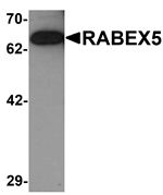 RABEX5 Antibody