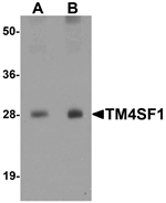 TM4SF1 Antibody