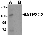 ATP2C2 Antibody