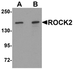 ROCK2 Antibody