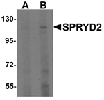 SPRYD2 Antibody