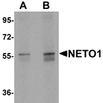 NETO1 Antibody