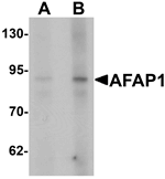 AFAP1 Antibody