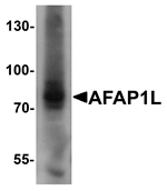 AFAP1L Antibody