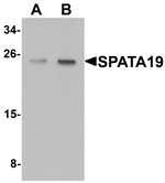 SPATA19 Antibody