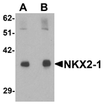 NKX2-1 Antibody