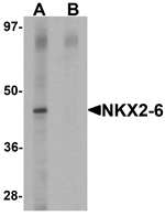 NKX2-6 Antibody