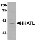 HHATL Antibody