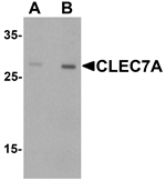 CLEC7A Antibody