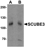 SCUBE3 Antibody