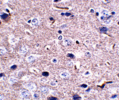 PD-1 Monoclonal Antibody