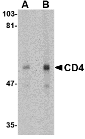 CD4 Monoclonal Antibody