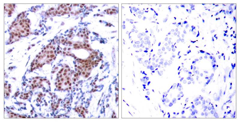 Elk-1(Phospho-Ser383) Antibody