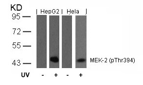 MEK2(Phospho-Thr394) Antibody