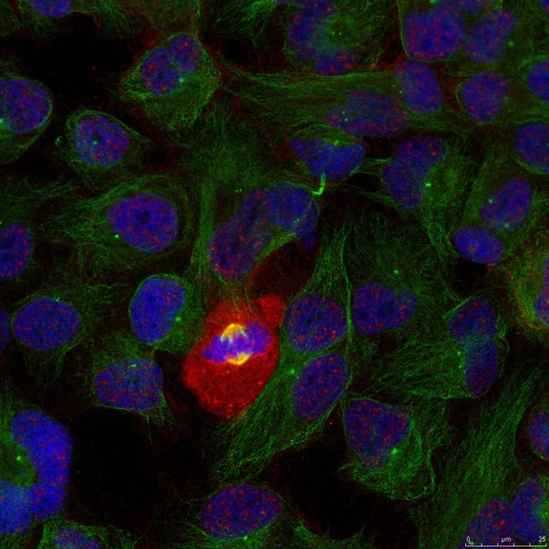 NFkB-p65(Phospho-Thr254) Antibody