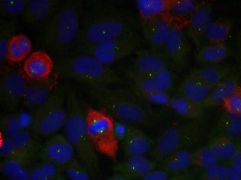 NFkB-p65(Phospho-Thr435) Antibody