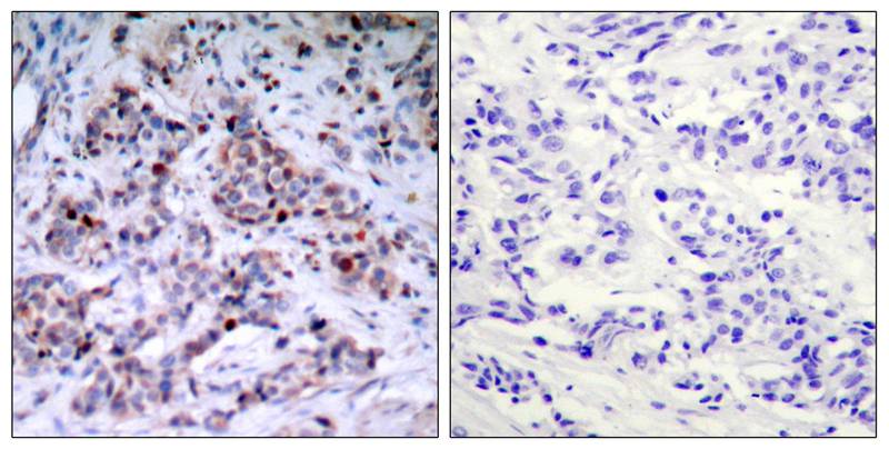 NFkB-p65(Phospho-Thr435) Antibody