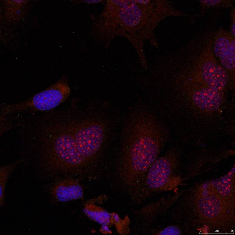 JunB(Phospho-Ser79) Antibody