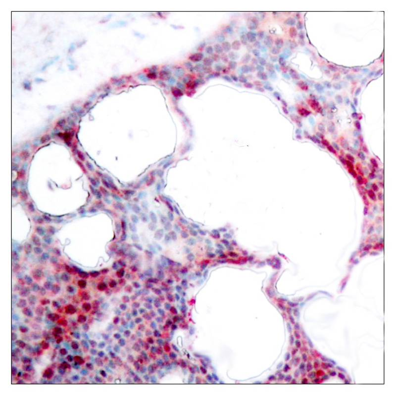 ATF2(Phospho-Ser62 or 44) Antibody