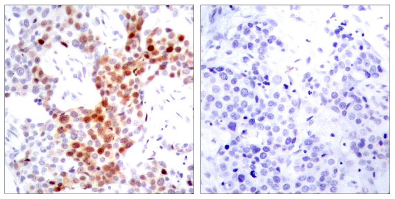 ATF2(Phospho-Thr69 or 51) Antibody