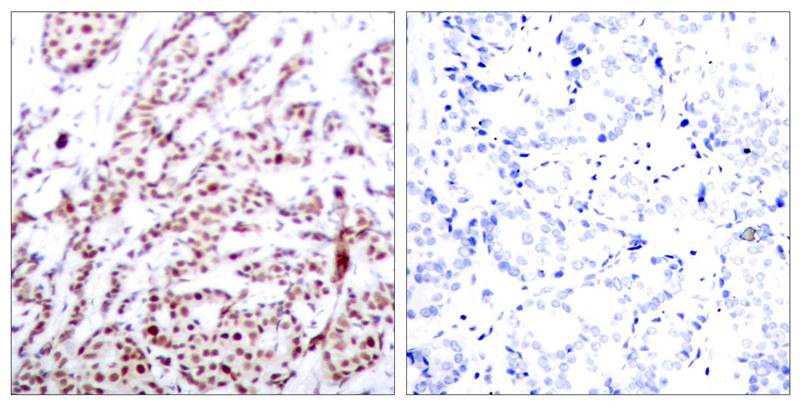 ATF2(Phospho-Thr73 or 55) Antibody