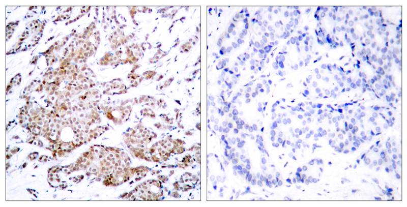 Myc(Phospho-Thr58) Antibody